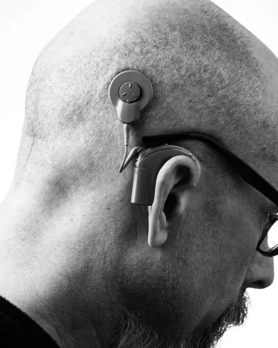 Baha 7 de Cochlear remboursé : une bonne nouvelle